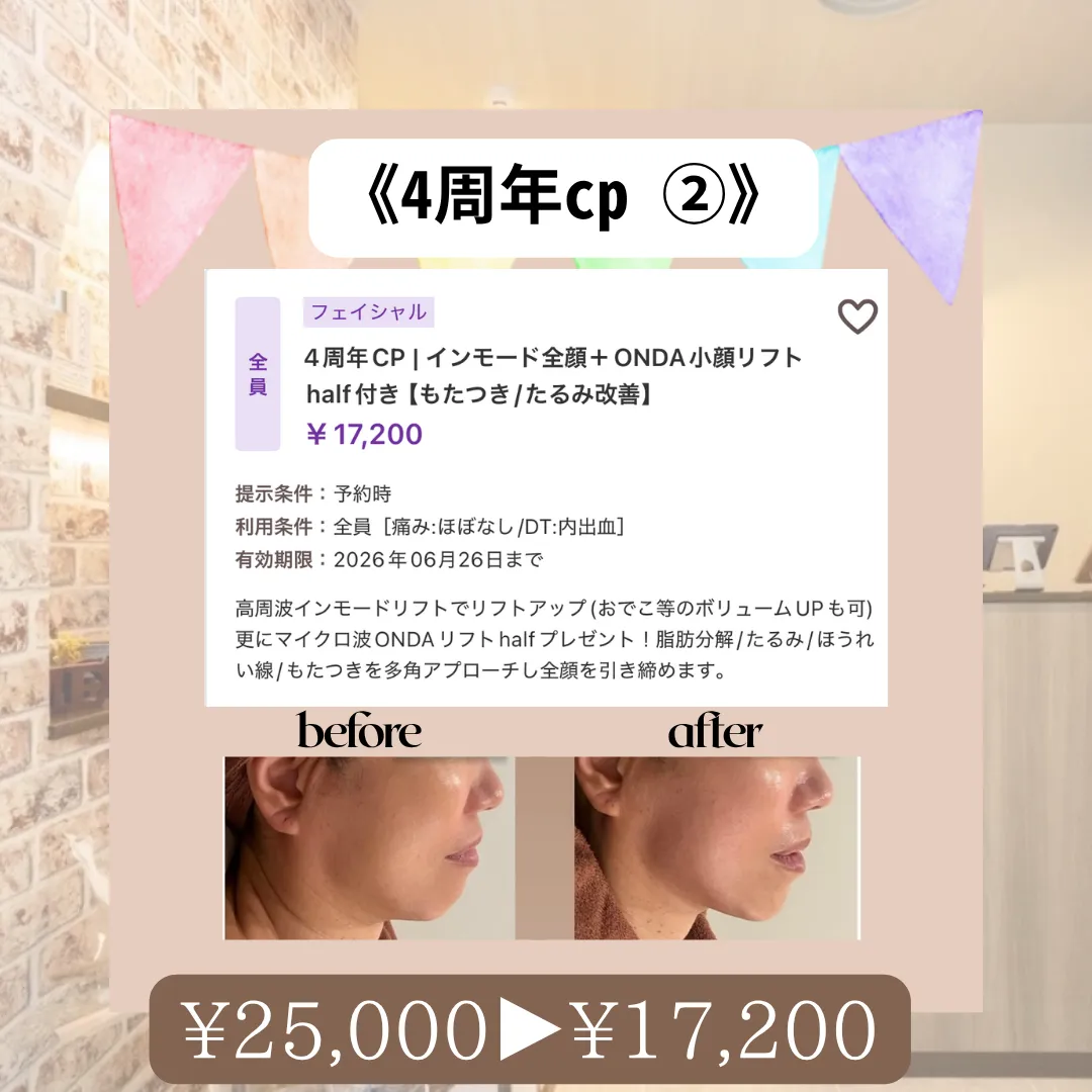 【柏駅】4周年CP2💐脂肪分解×ハリUP×たるみ改善×細胞活性🌞