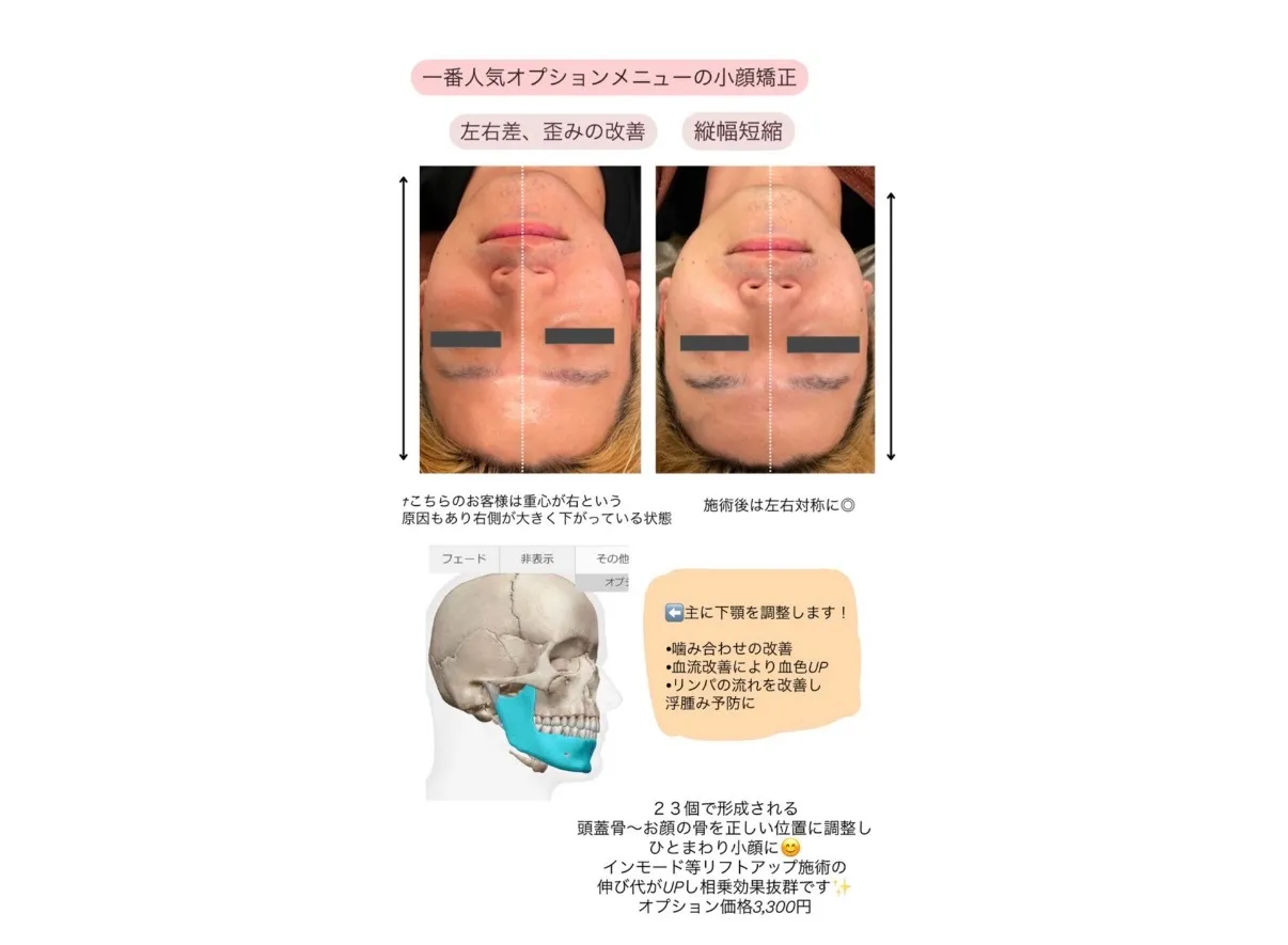 【柏市】前半◎左右差・歪み改善💗小顔矯正で浮腫みや老化予防💆‍♀️✨
