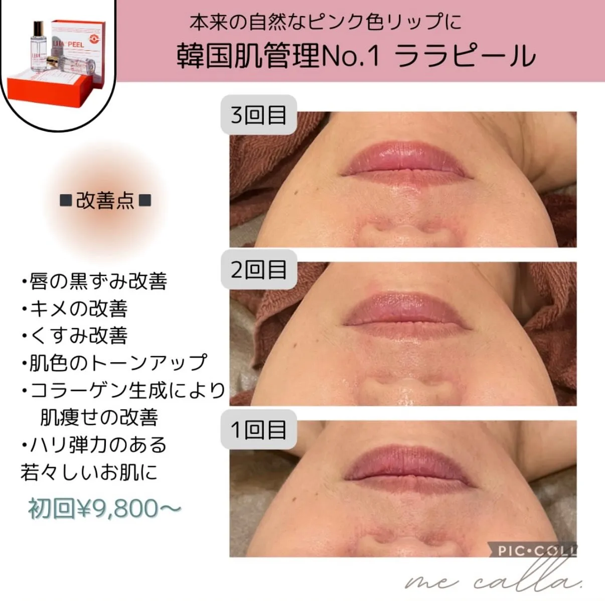 【柏市】アートメイクのようなピンク色リップに💋ララピールBA