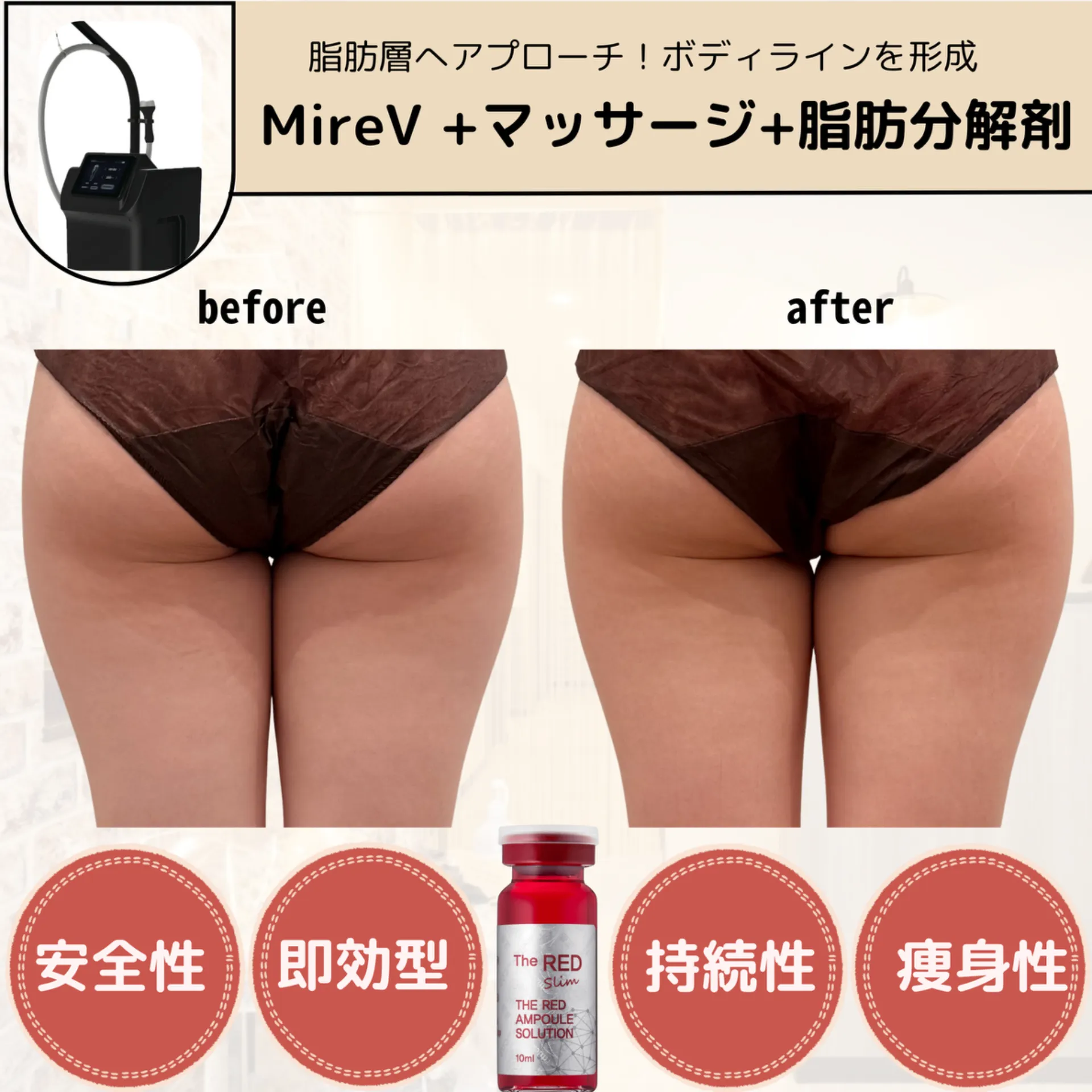 【柏市】mirev+脂肪分解マッサージ+プラズマ+脂肪分解剤導入👐