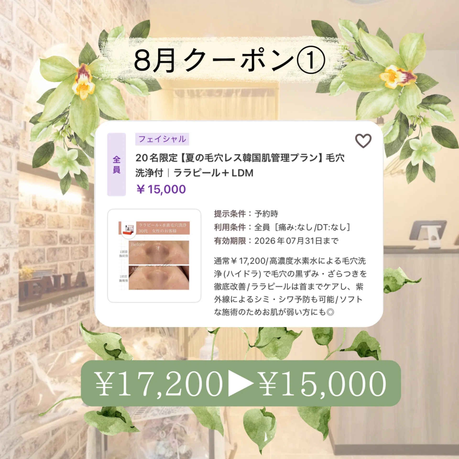 【柏駅】8月クーポン1️⃣毛穴洗浄+ララピール+水玉🫧ツヤUP◎
