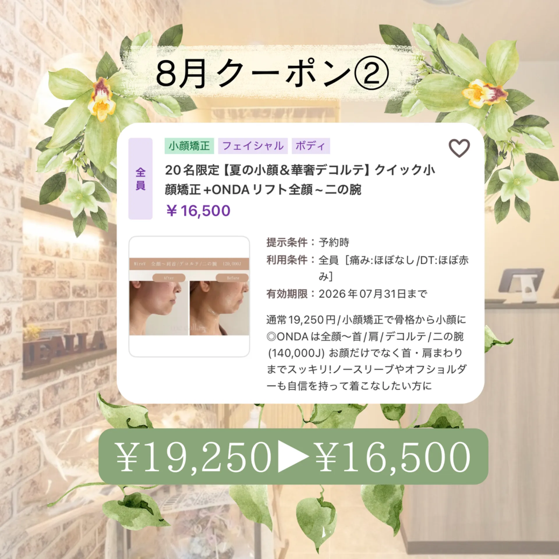 【柏市】8月クーポン2️⃣小顔矯正×ONDA全額~二の腕14万J🙆♀️