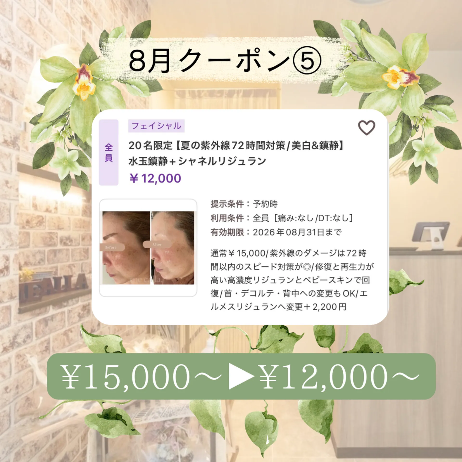 【柏駅】8月クーポン5️⃣プラズマ×リジュラン×水玉鎮静◎