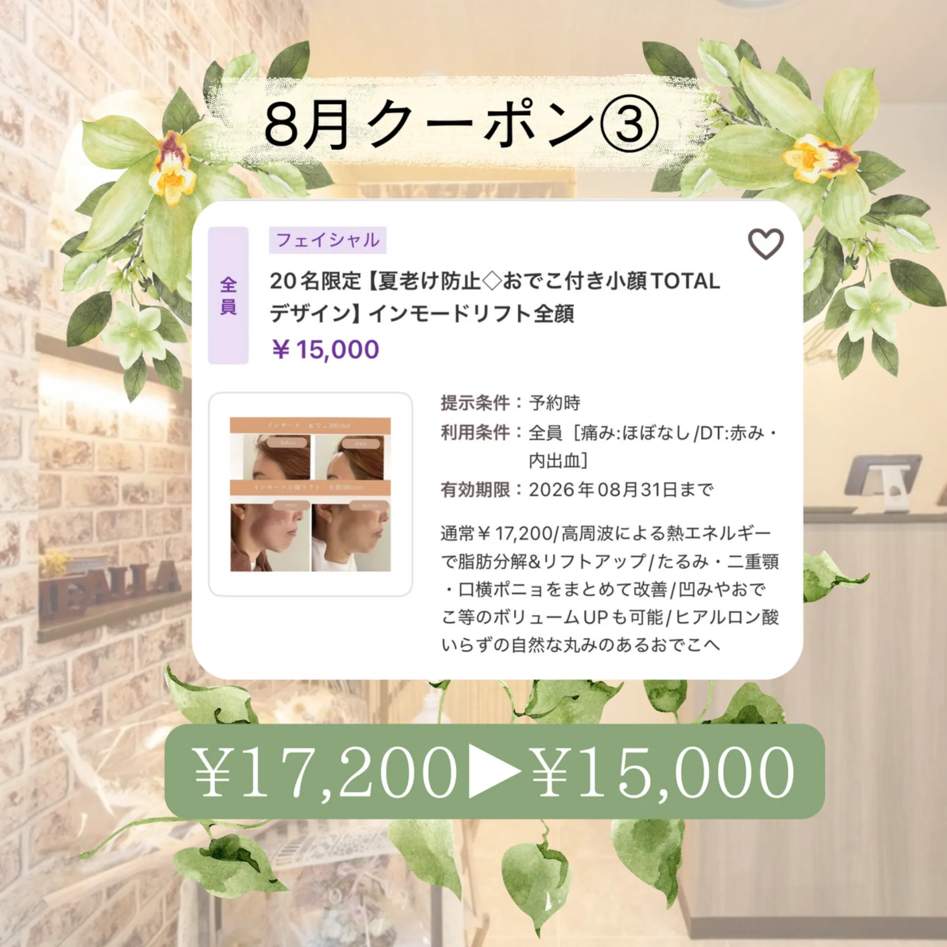 【柏駅】8月クーポン3️⃣インモード全顔+水玉リフティング