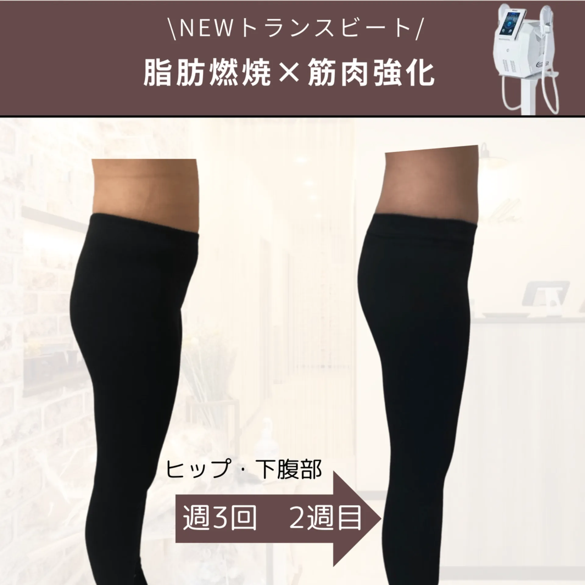 【柏駅】ONDA後の仕上げにトランスビート！筋肉強化🔥×脂肪ケア💪