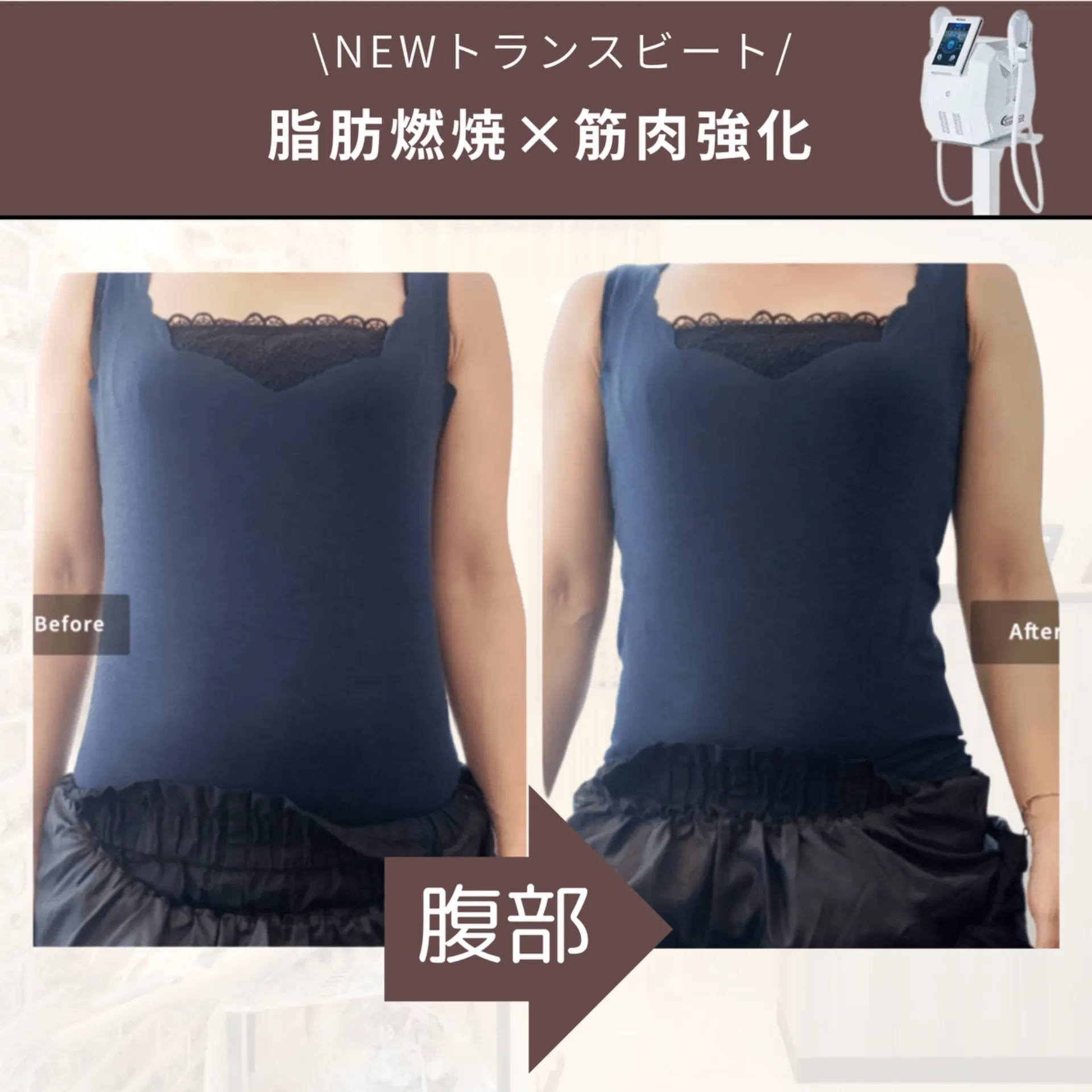 【柏市】ONDA BODY×トランスビート🙌寝ているだけでライン変化♻️