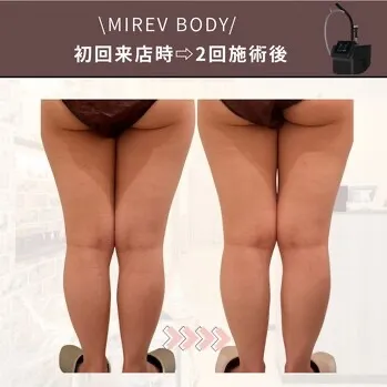 【柏駅】 太ももの隙間＆下半身痩せを目指す方必見🦵👀